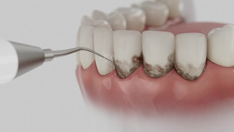 Trusted Root Canal Treatment service in St. Gabriel, LA - Dentist Open Now